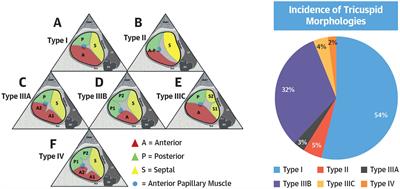 New therapeutic approach for tricuspid regurgitation: Transcatheter tricuspid valve replacement or repair